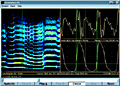 VoceVista-<b>Audio</b>